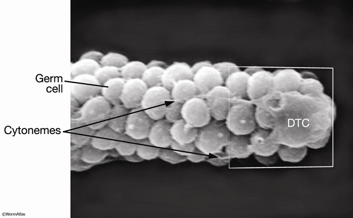 EMSEMDissectionFIG 1: Scanning electron micrograph of the DTC.C